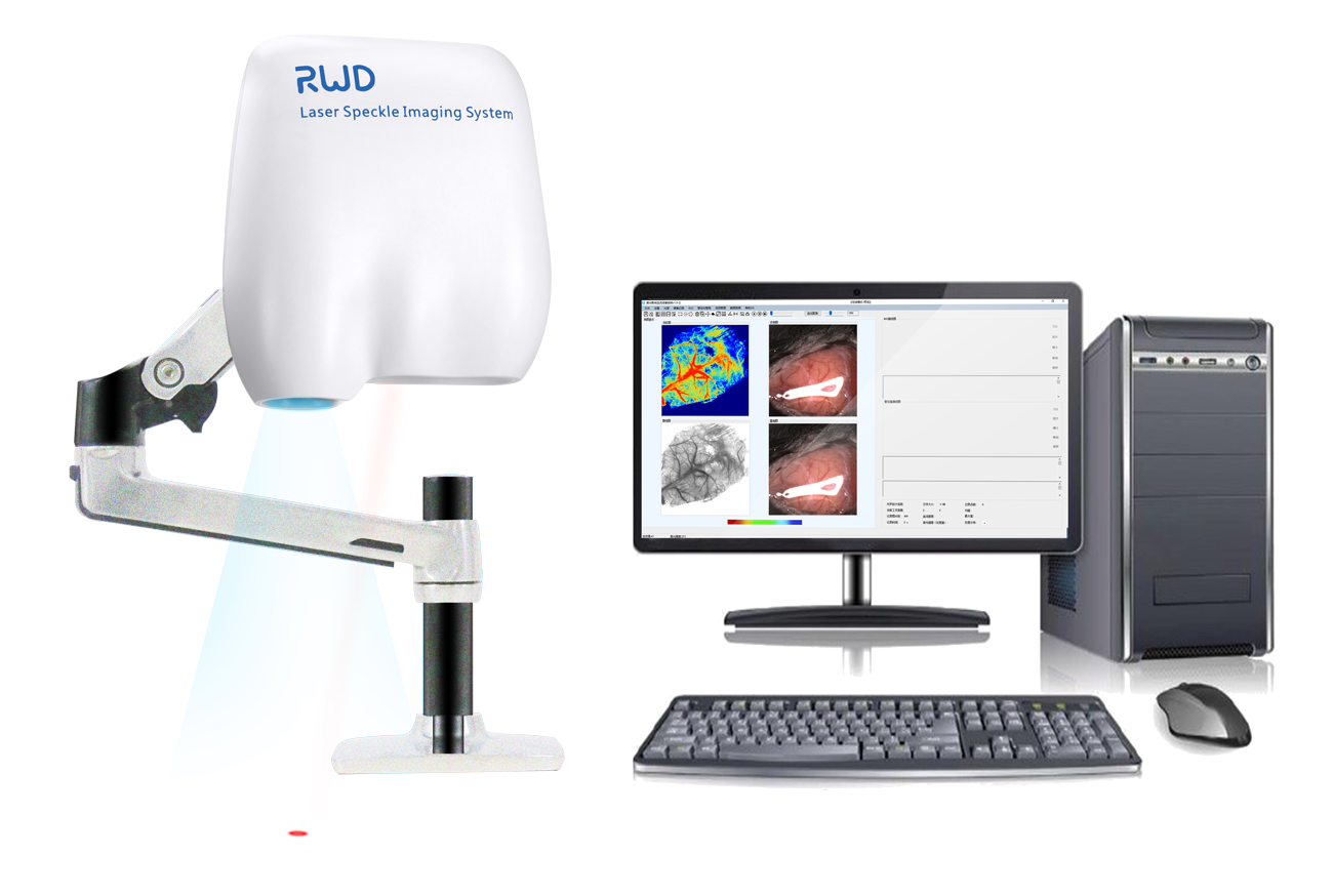 Laser Speckle Imaging system